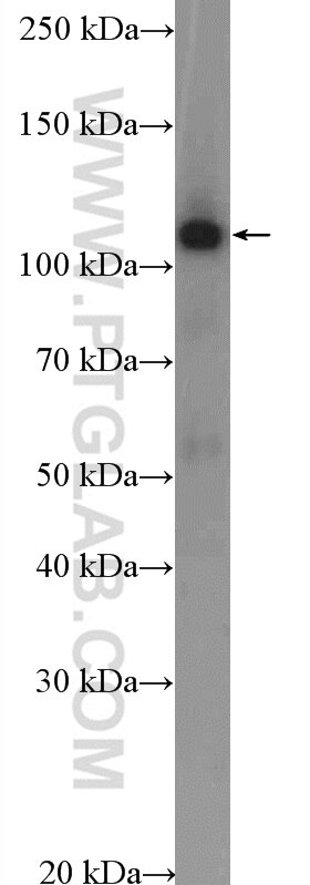 Western Blot (WB) analysis of HepG2 cells using SKIV2L2 Polyclonal antibody (12719-2-AP)