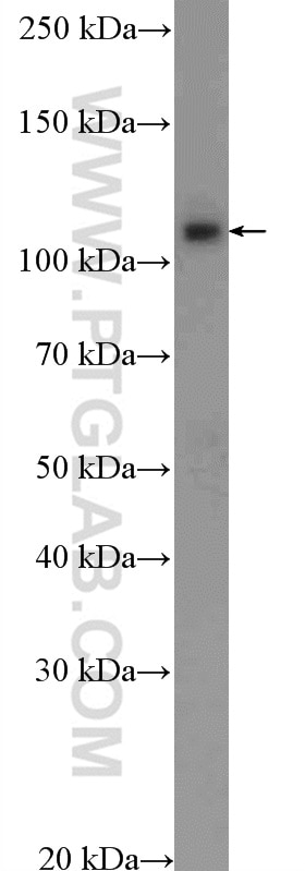 Western Blot (WB) analysis of HepG2 cells using SKIV2L2 Polyclonal antibody (12719-2-AP)