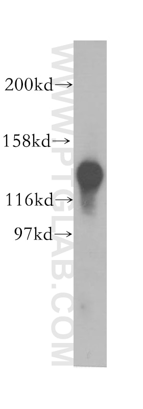 Western Blot (WB) analysis of human brain tissue using SKIV2L2 Polyclonal antibody (12719-2-AP)