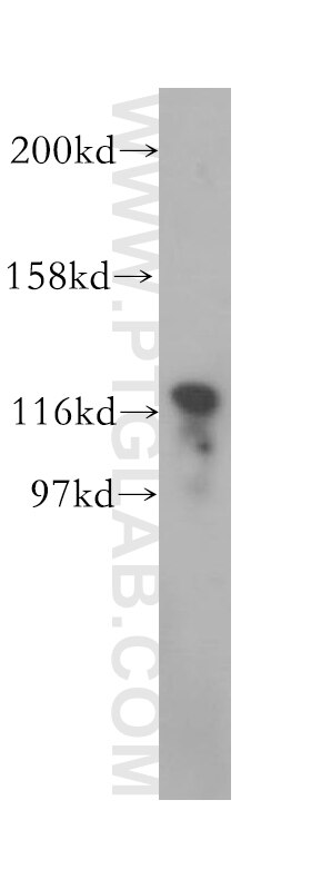 Western Blot (WB) analysis of mouse testis tissue using SKIV2L2 Polyclonal antibody (12719-2-AP)