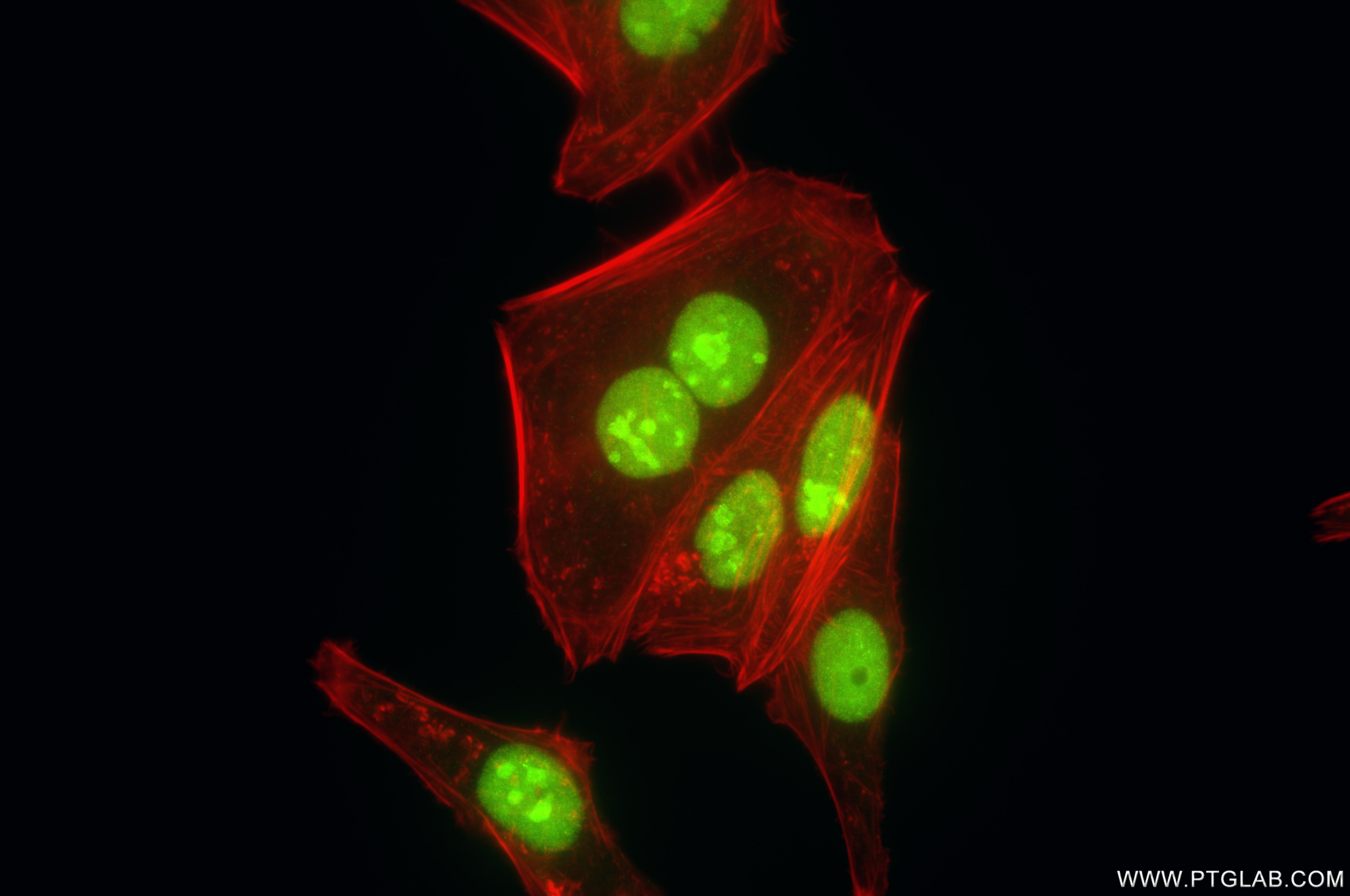 Immunofluorescent analysis of (4% PFA) fixed HepG2 cells using SKIV2L2 antibody (86536-1-RR, Clone: 251430D11 ) at dilution of 1:800 and CoraLite®488-Conjugated Goat Anti-Rabbit IgG(H+L) (SA00013-2), CL594-Phalloidin (red). Immunofluorescence (IF) / fluorescent staining of HepG2 cells using SKIV2L2 Recombinant antibody (86536-1-RR)