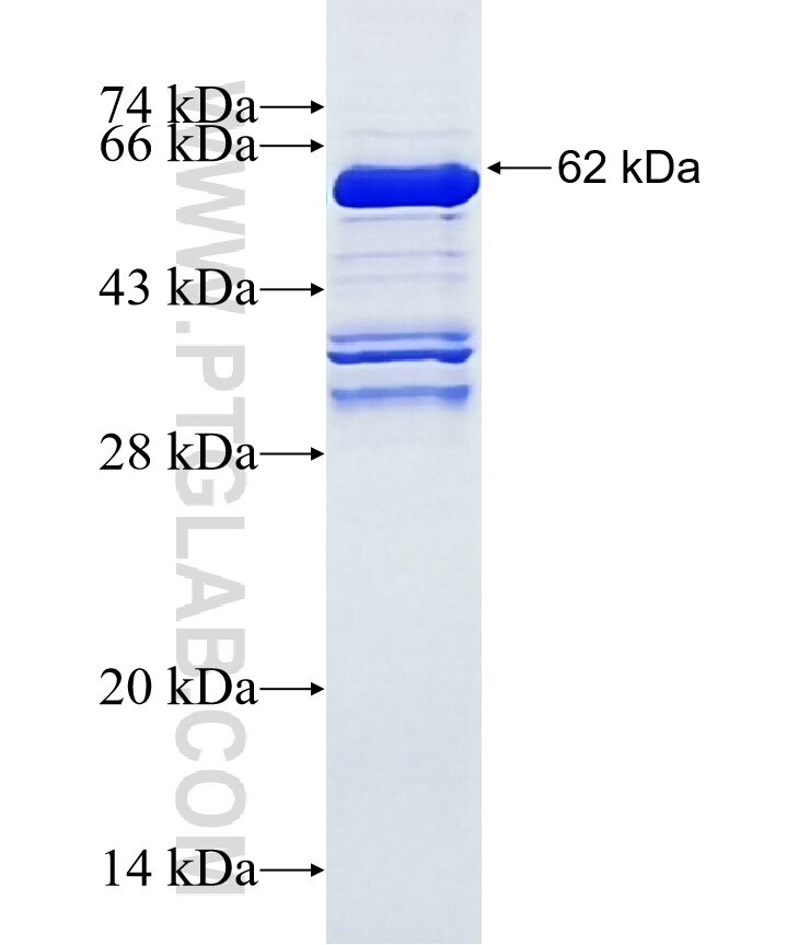 SKIV2L2 fusion protein Ag3414 SDS-PAGE