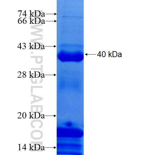SKIV2L2 fusion protein Ag4370 SDS-PAGE