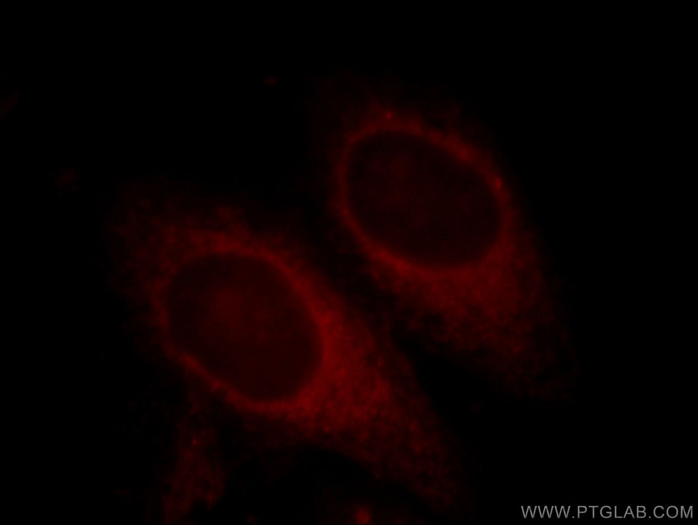 IF Staining of HepG2 using 10990-2-AP