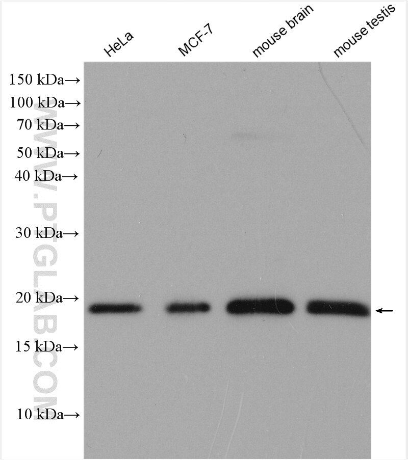 Western Blot (WB) analysis of various lysates using SKP1 Polyclonal antibody (10990-2-AP)