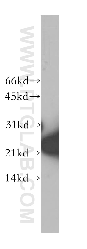 Western Blot (WB) analysis of human brain tissue using SKP1 Polyclonal antibody (10990-2-AP)