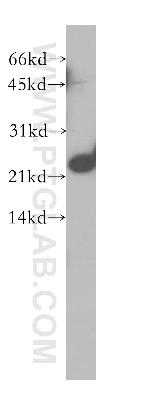 Western Blot (WB) analysis of HeLa cells using SKP1 Polyclonal antibody (10990-2-AP)