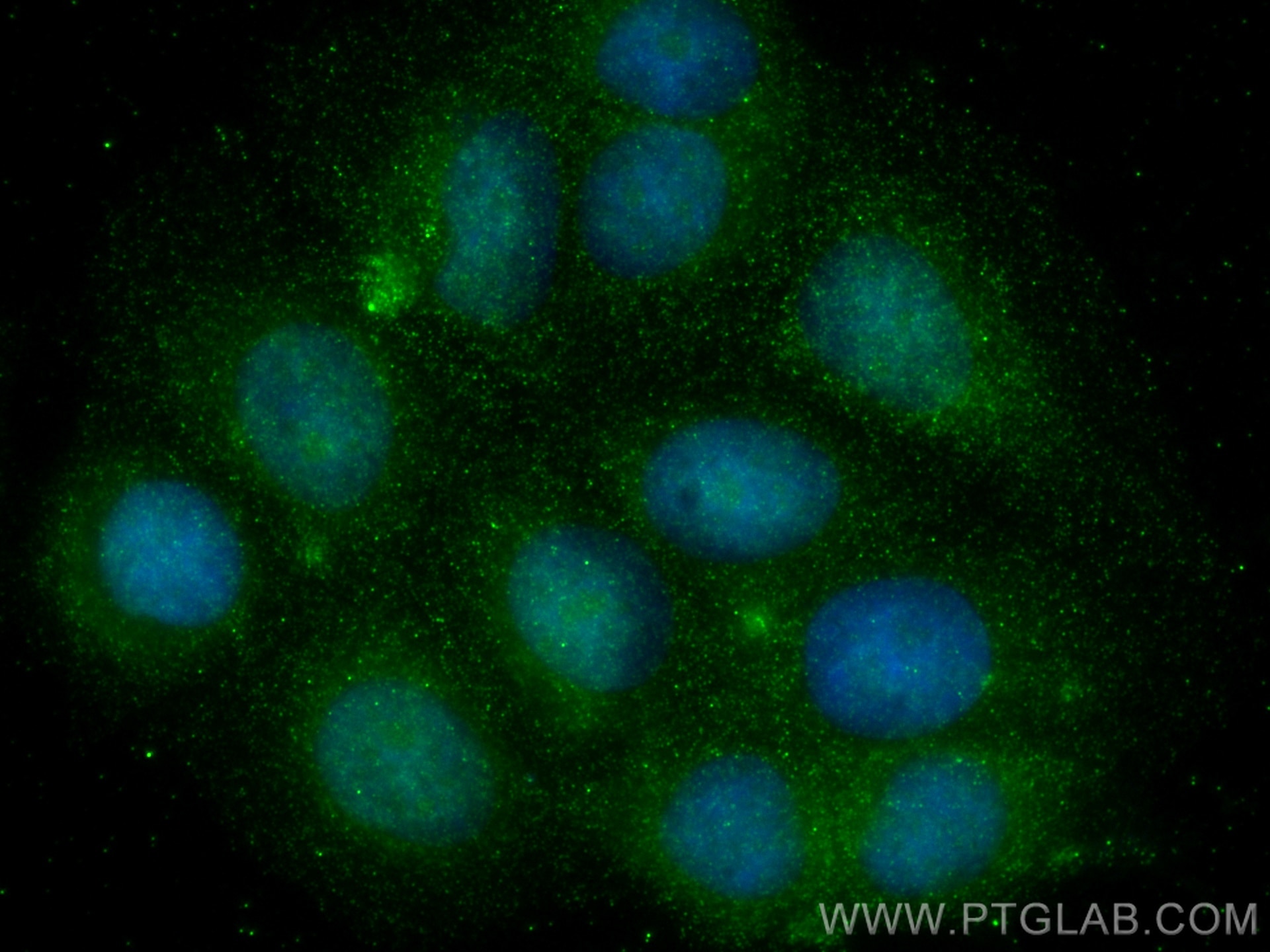 Immunofluorescence (IF) / fluorescent staining of MCF-7 cells using SKP1 Monoclonal antibody (67745-1-Ig)