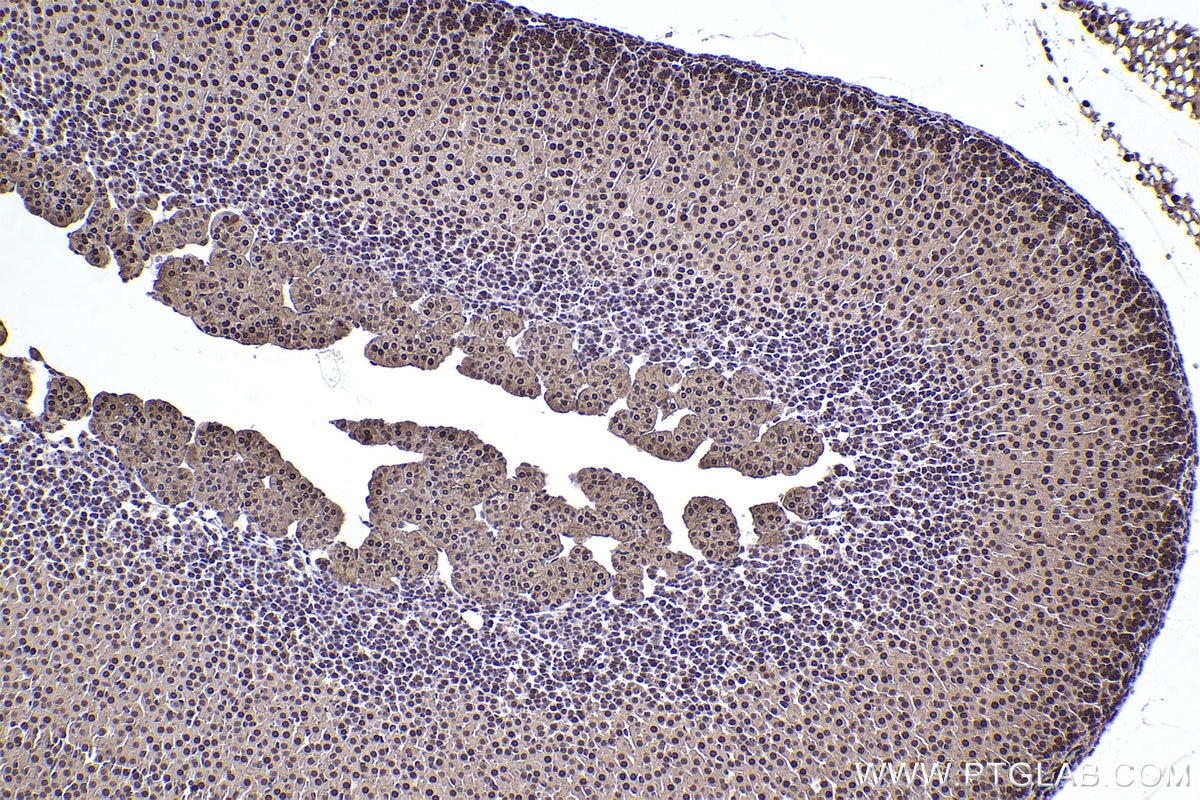 IHC staining of mouse adrenal gland using 67745-1-Ig Immunohistochemistry (IHC) staining of mouse adrenal gland tissue using SKP1 Monoclonal antibody (67745-1-Ig)