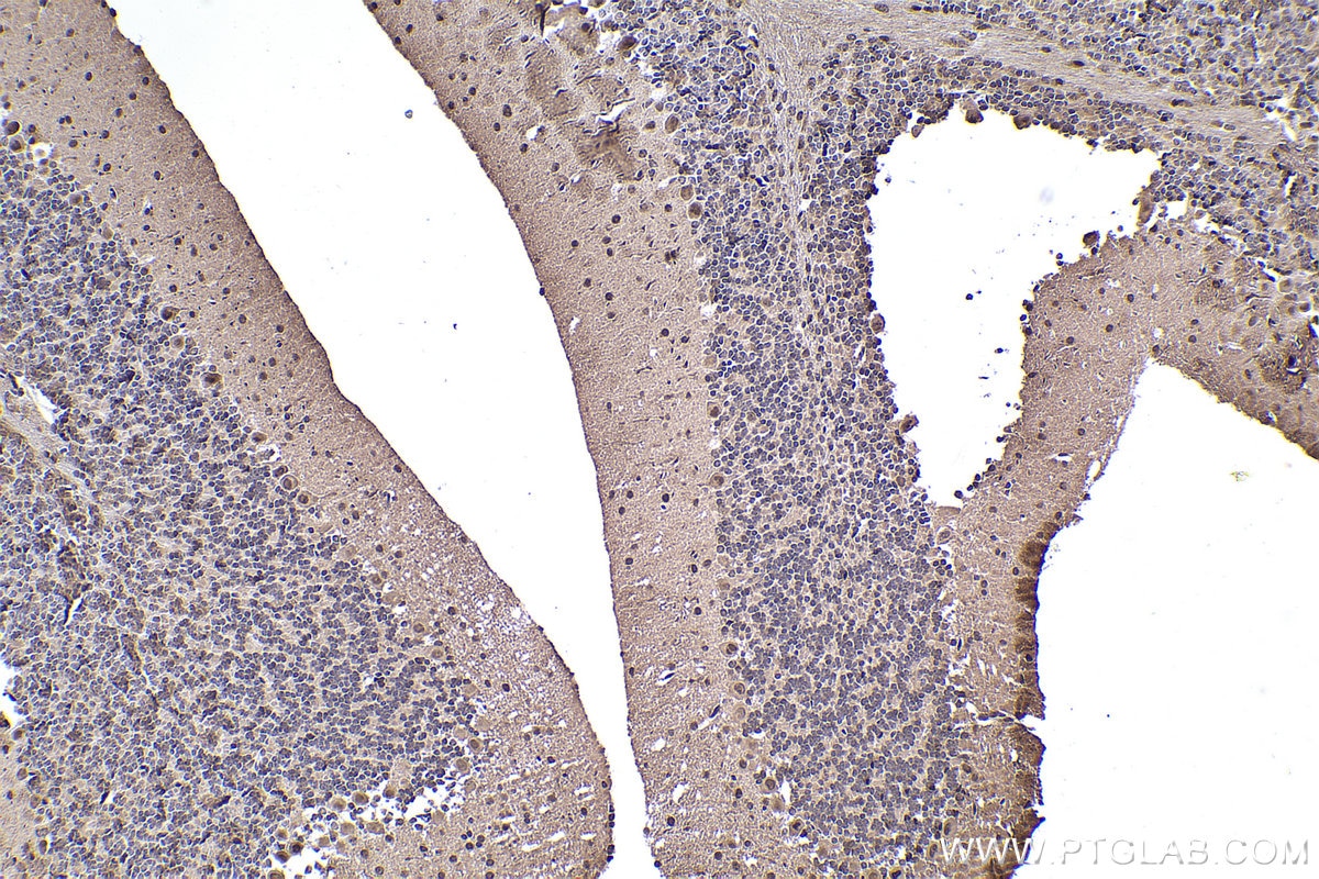 IHC staining of mouse cerebellum using 67745-1-Ig Immunohistochemistry (IHC) staining of mouse cerebellum tissue using SKP1 Monoclonal antibody (67745-1-Ig)