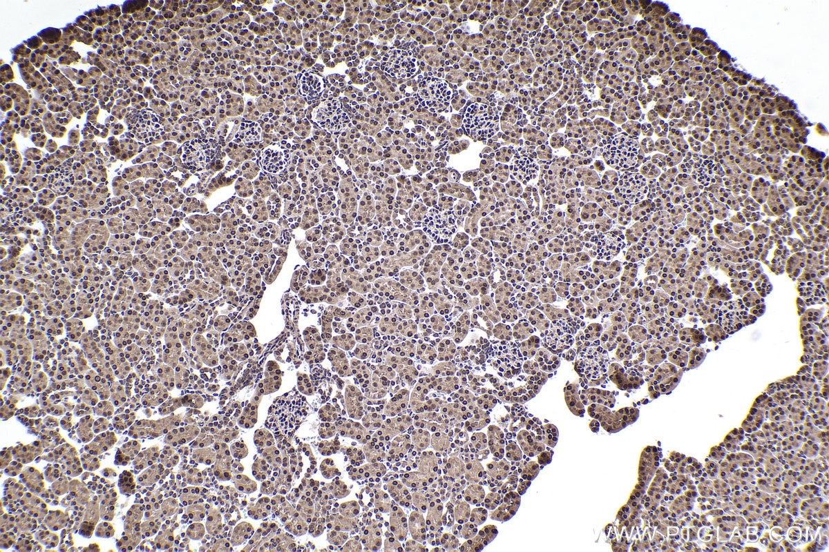 IHC staining of mouse kidney using 67745-1-Ig Immunohistochemistry (IHC) staining of mouse kidney tissue using SKP1 Monoclonal antibody (67745-1-Ig)
