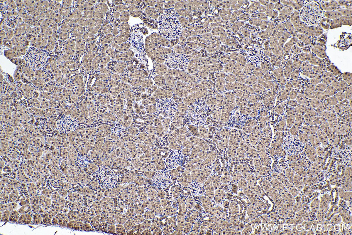IHC staining of rat kidney using 67745-1-Ig Immunohistochemistry (IHC) staining of rat kidney tissue using SKP1 Monoclonal antibody (67745-1-Ig)