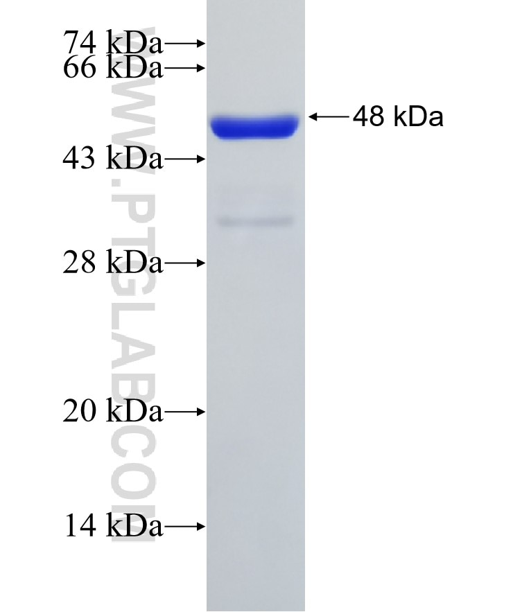 SKP1 fusion protein Ag1457 SDS-PAGE