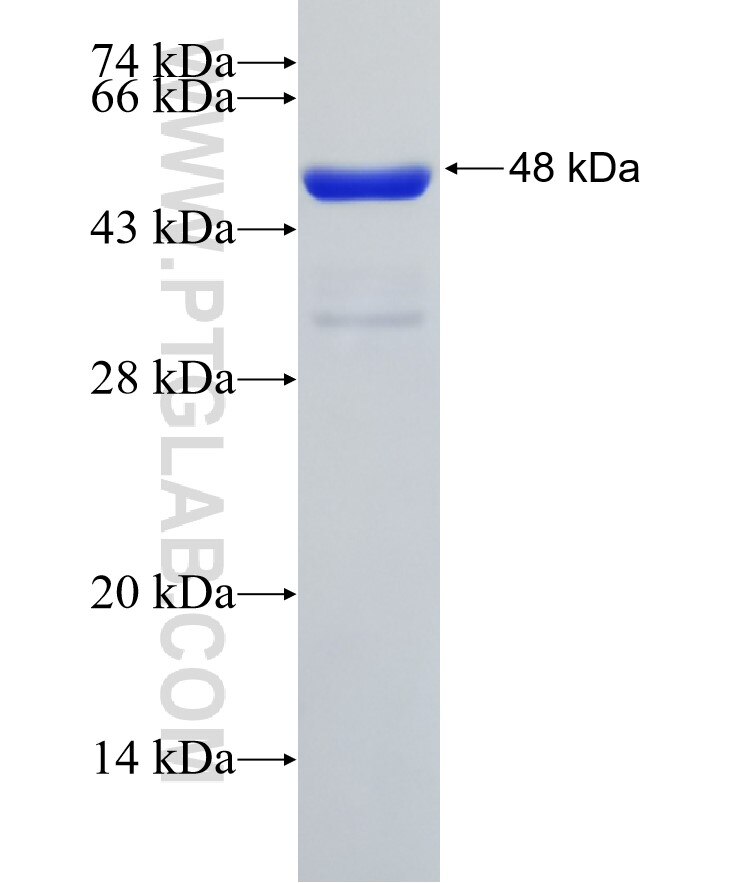 SKP1 fusion protein Ag1457 SDS-PAGE