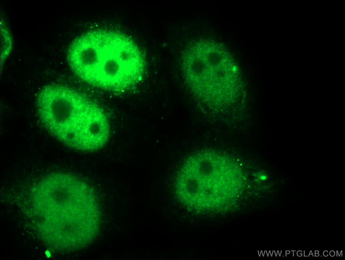 Immunofluorescence (IF) / fluorescent staining of HepG2 cells using SKP2 Polyclonal antibody (15010-1-AP)