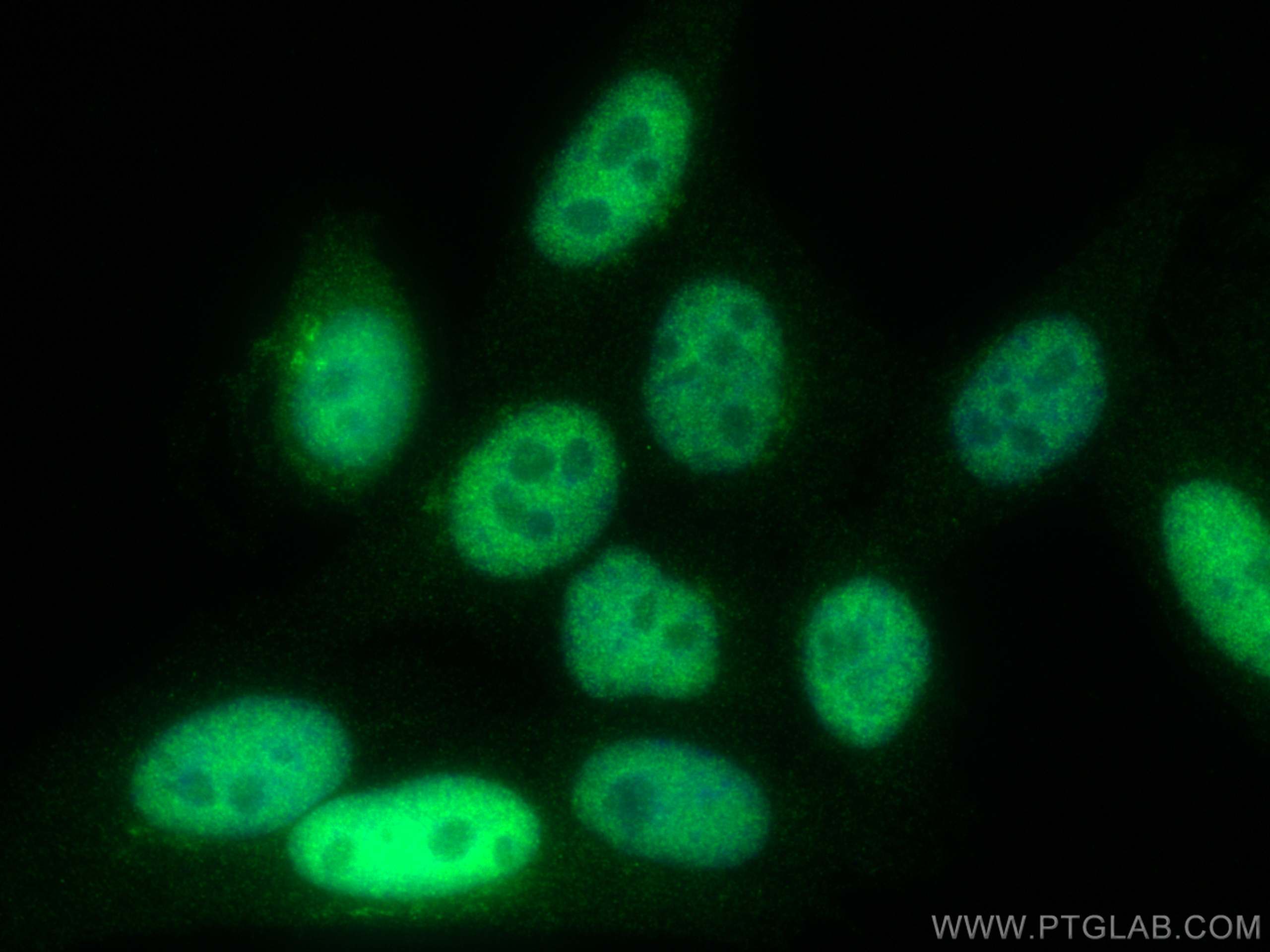 Immunofluorescence (IF) / fluorescent staining of HepG2 cells using SKP2 Polyclonal antibody (15010-1-AP)