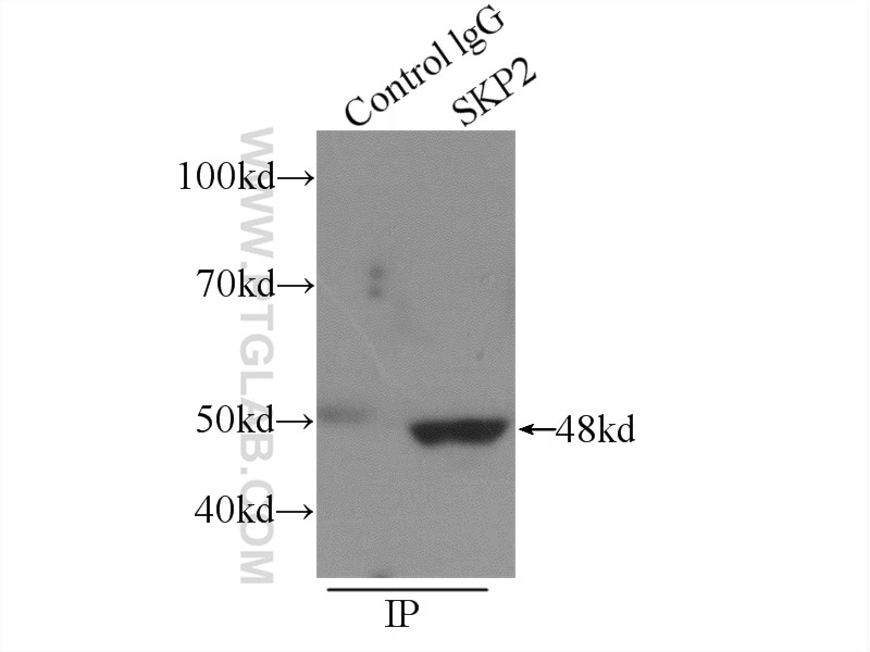 SKP2 Polyclonal antibody