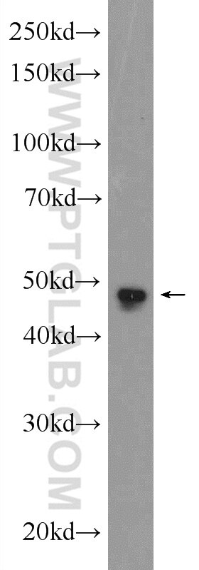 SKP2 Polyclonal antibody