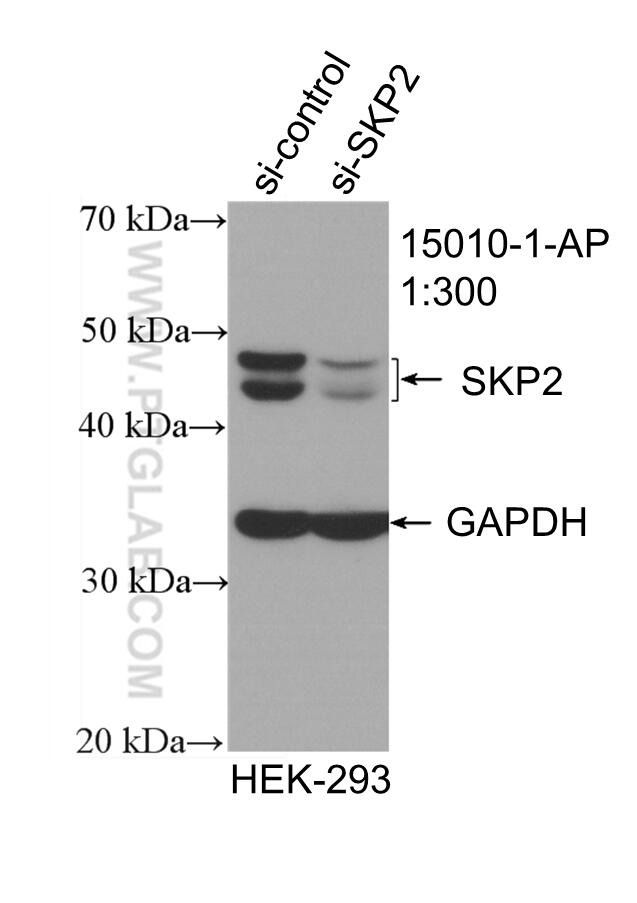 Western Blot (WB) analysis of HEK-293 cells using SKP2 Polyclonal antibody (15010-1-AP)
