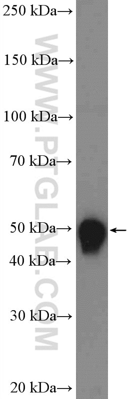 Western Blot (WB) analysis of Jurkat cells using SKP2 Polyclonal antibody (15010-1-AP)