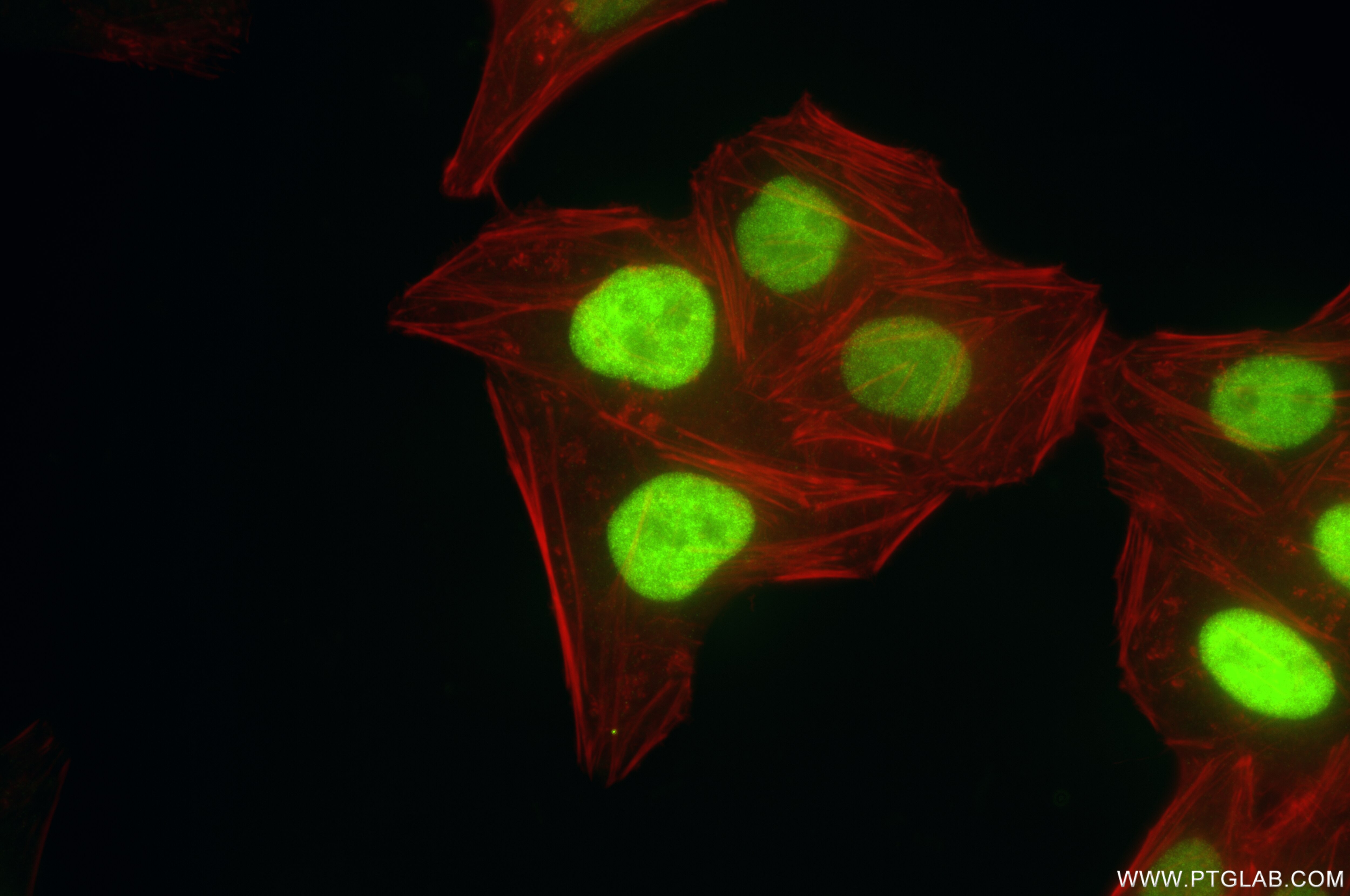 Immunofluorescence (IF) / fluorescent staining of HepG2 cells using SKP2 Recombinant antibody (85670-4-RR)