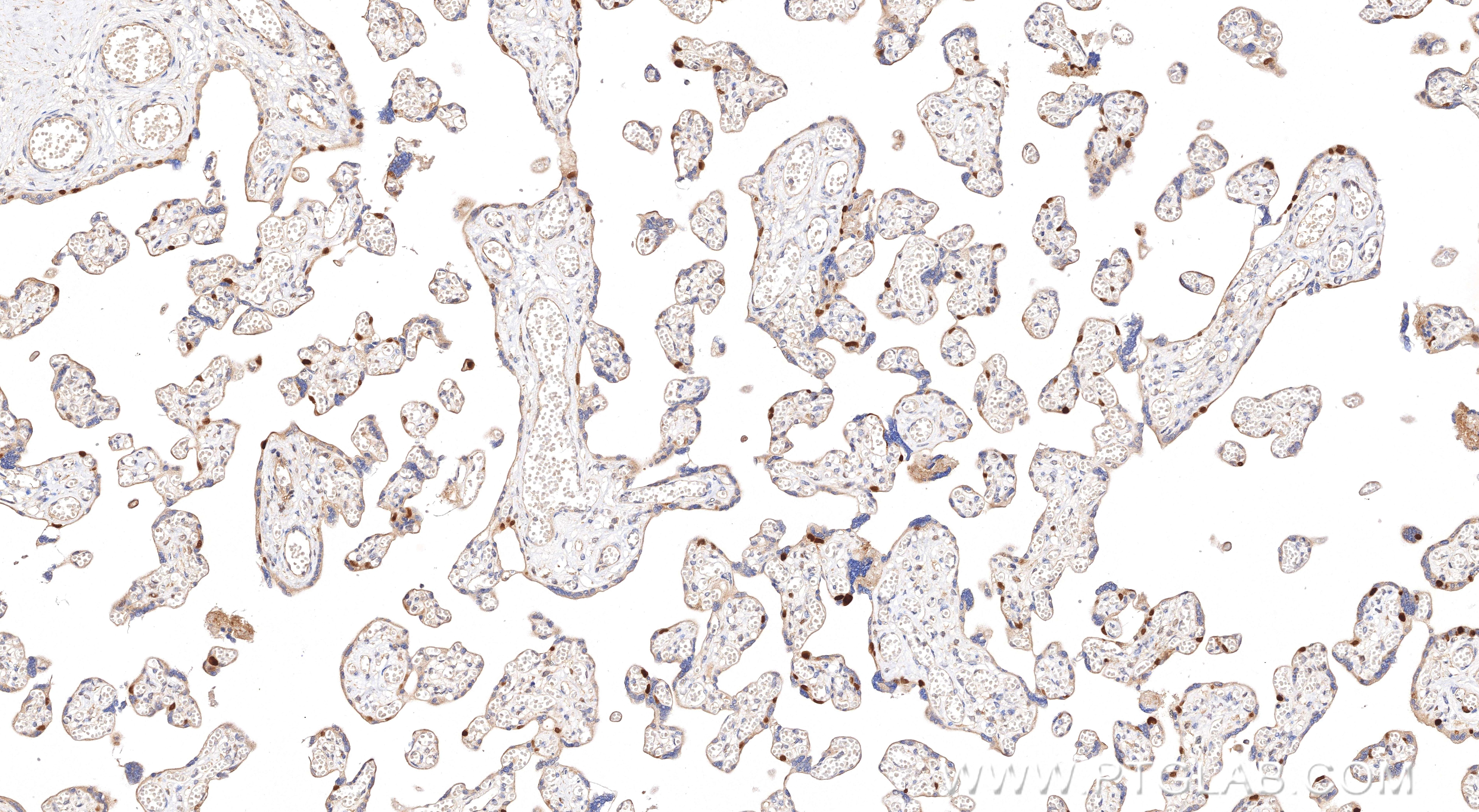 Immunohistochemical analysis of paraffin-embedded human placenta tissue slide using 85670-4-RR (SKP2 antibody) at dilution of 1:1000 (under 10x lens). Heat mediated antigen retrieval with Tris-EDTA buffer (pH 9.0). Immunohistochemistry (IHC) staining of human placenta tissue using SKP2 Recombinant monoclonal antibody (85670-4-RR)
