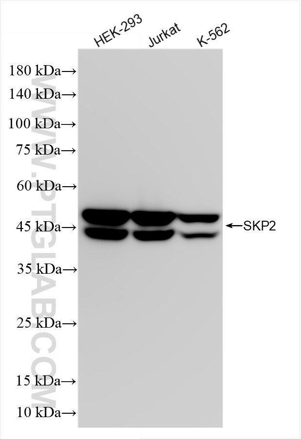 SKP2