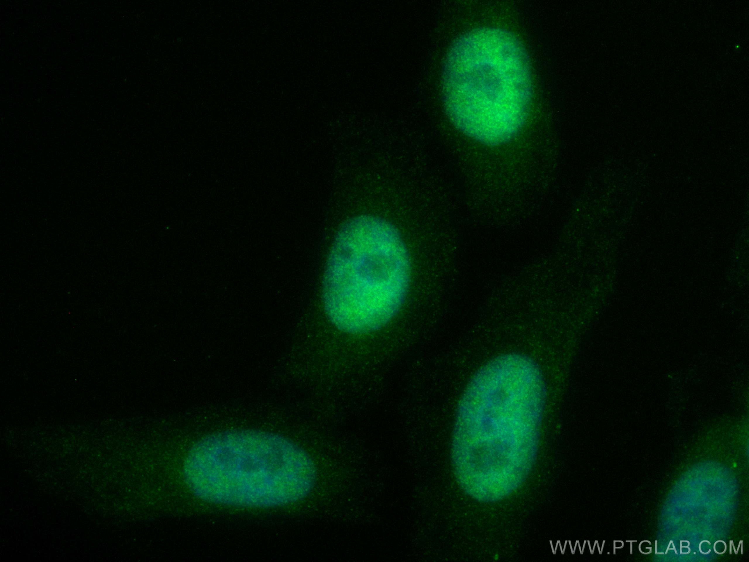 Immunofluorescence (IF) / fluorescent staining of HepG2 cells using CoraLite® Plus 488-conjugated SKP2 Polyclonal anti (CL488-15010)