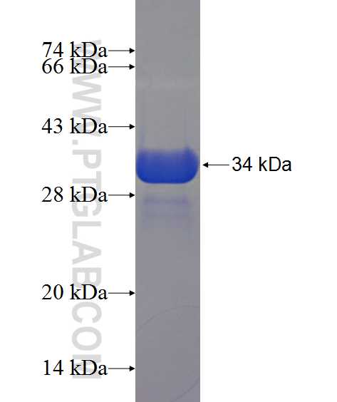SLA fusion protein Ag13181 SDS-PAGE