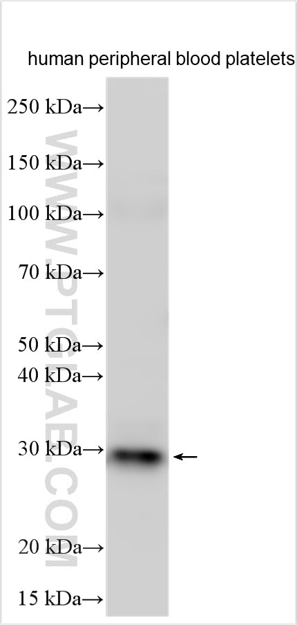 Western Blot (WB) analysis of various lysates using SLA2 Polyclonal antibody (14152-1-AP)