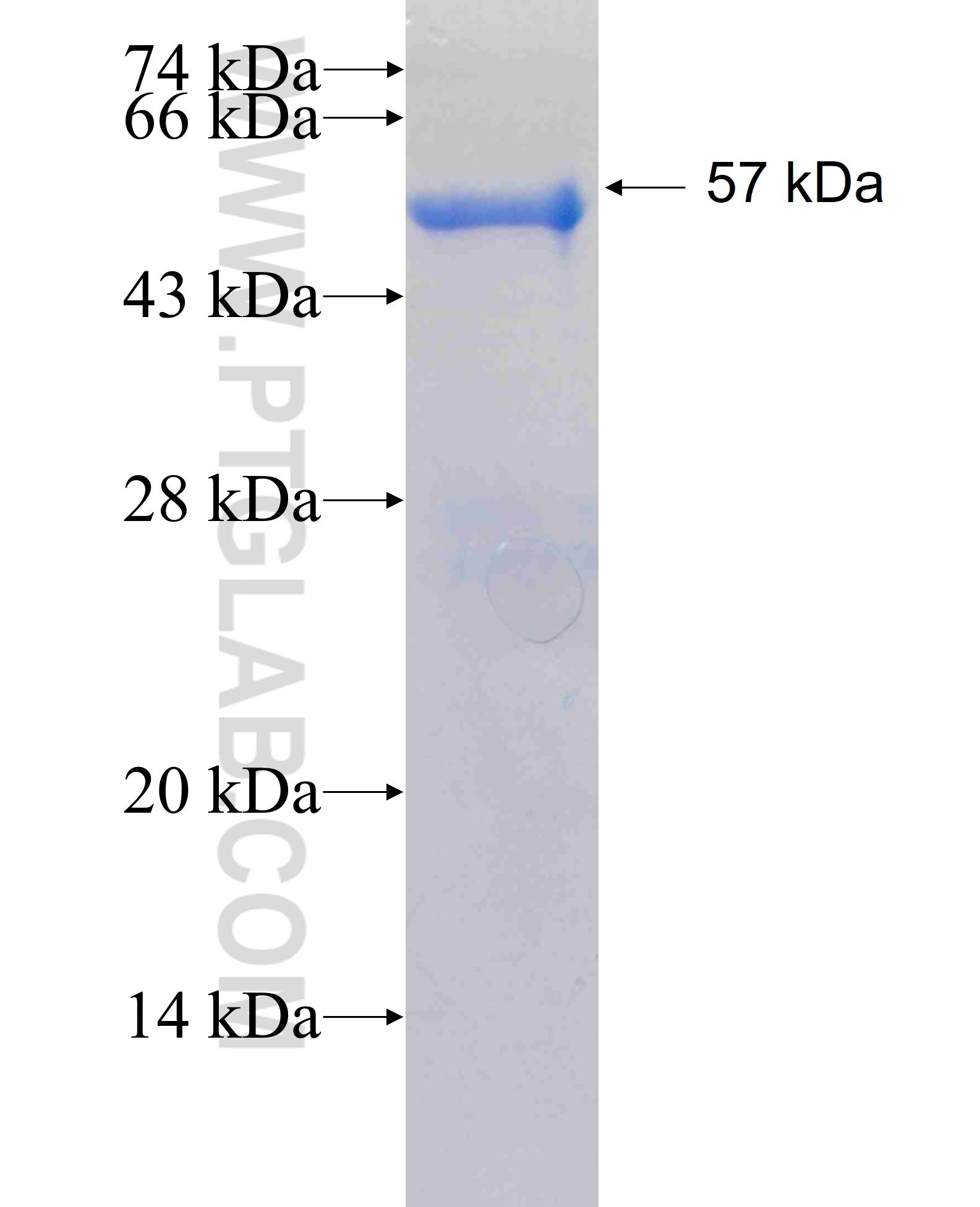 SLA2 fusion protein Ag5334 SDS-PAGE