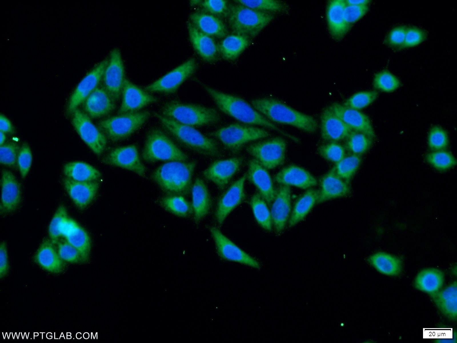 Immunofluorescence (IF) / fluorescent staining of HeLa cells using SLAIN1 Polyclonal antibody (22123-1-AP)