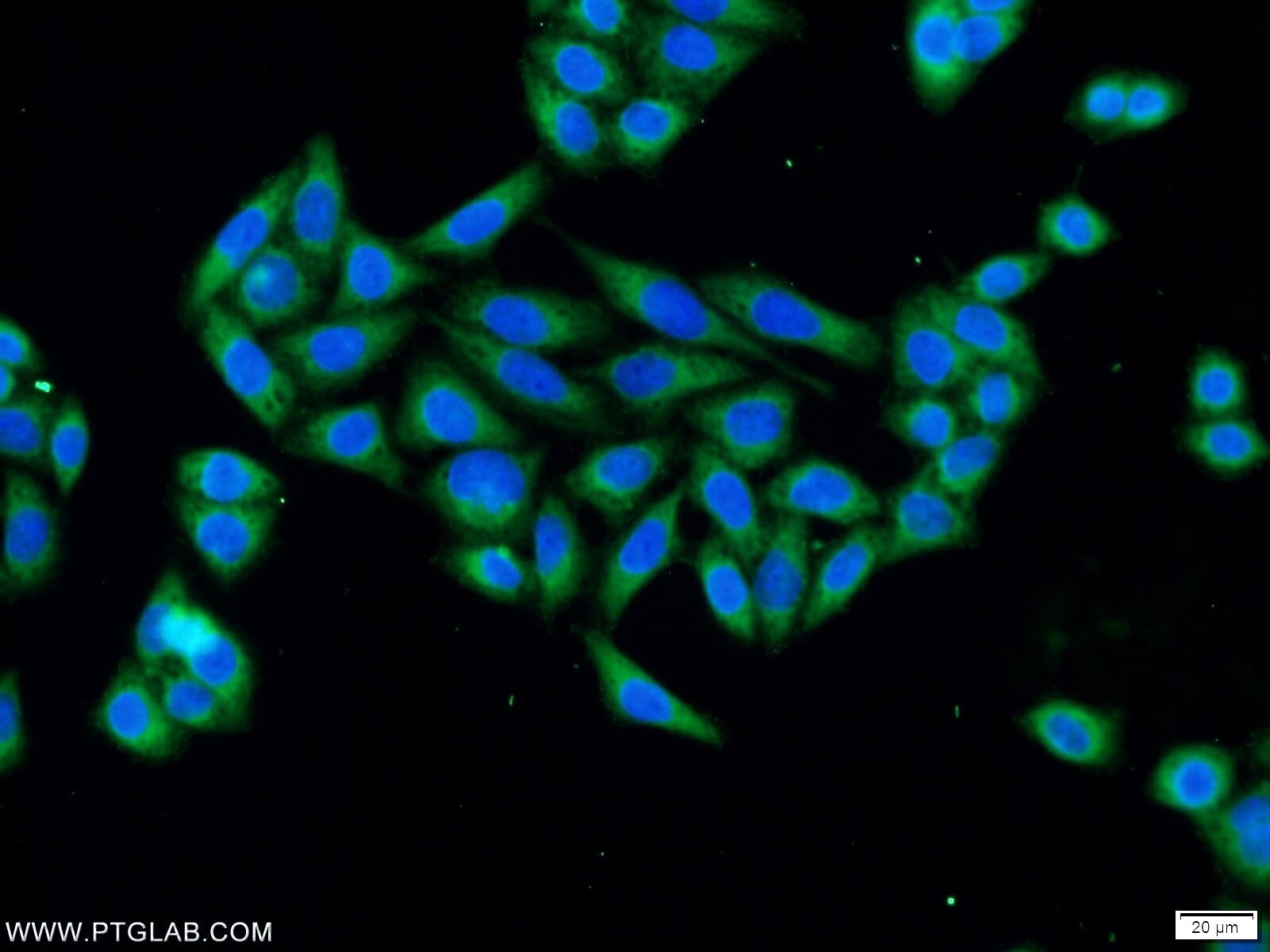 IF Staining of HeLa using 22123-1-AP