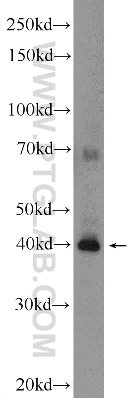 Western Blot (WB) analysis of HeLa cells using SLAIN1 Polyclonal antibody (22123-1-AP)
