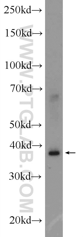 Western Blot (WB) analysis of mouse brain tissue using SLAIN1 Polyclonal antibody (22123-1-AP)