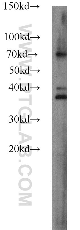 Western Blot (WB) analysis of HEK-293 cells using SLAIN1 Polyclonal antibody (22123-1-AP)