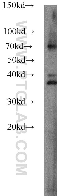 WB analysis of HEK-293 using 22123-1-AP