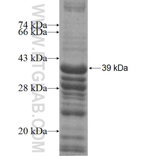 SLAIN1 fusion protein Ag4973 SDS-PAGE