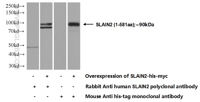 Western Blot (WB) analysis of Transfected HEK-293 cells using SLAIN2 Polyclonal antibody (13908-1-AP)