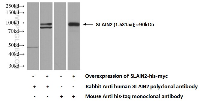 WB analysis of Transfected HEK-293 using 13908-1-AP