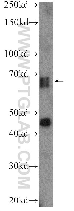 Western Blot (WB) analysis of mouse brain tissue using SLAIN2 Polyclonal antibody (13908-1-AP)