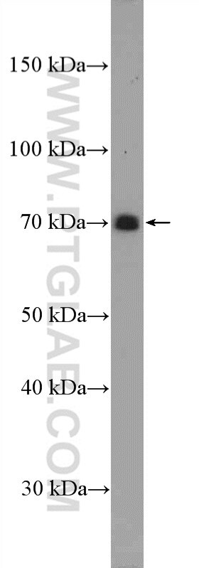 Western Blot (WB) analysis of Jurkat cells using SLAM/CD150 Polyclonal antibody (10949-2-AP)