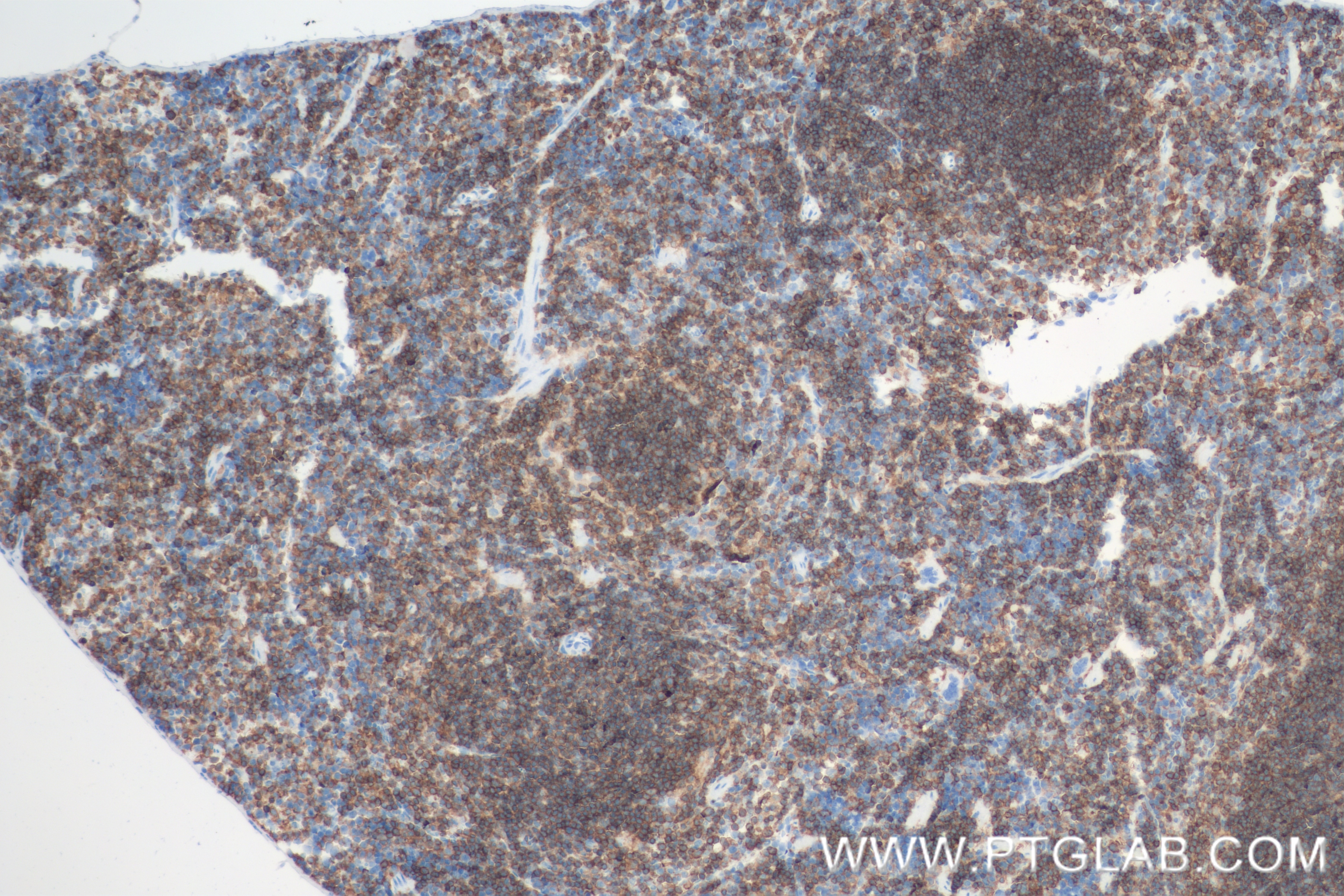 Immunohistochemistry (IHC) staining of mouse spleen tissue using SLAMF3/CD229 Recombinant antibody (84817-4-RR)