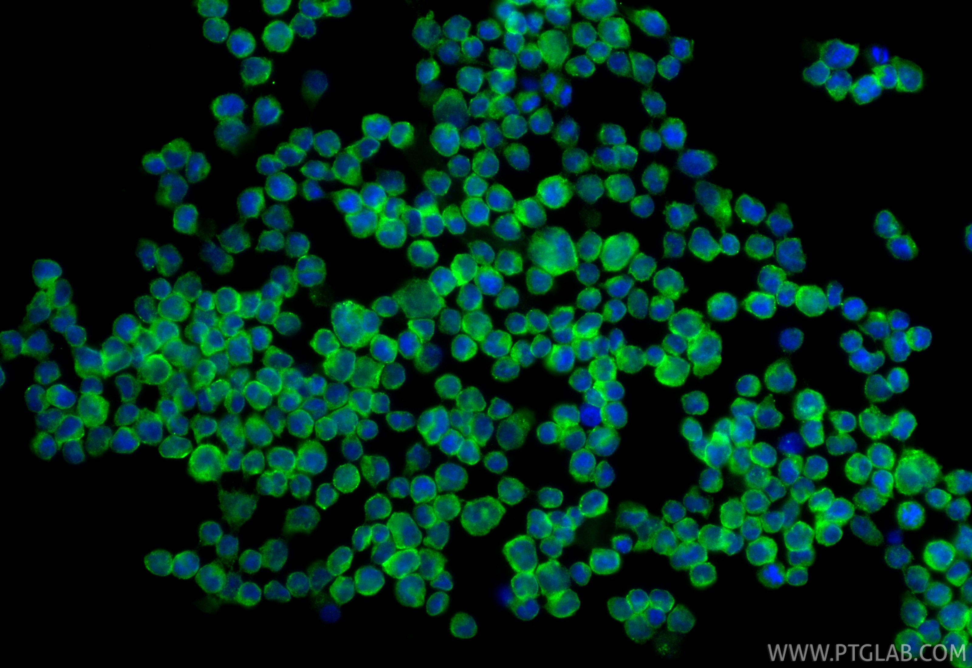 Immunofluorescence (IF) / fluorescent staining of Daudi cells using NTB-A/SLAMF6 Polyclonal antibody (22711-1-AP)