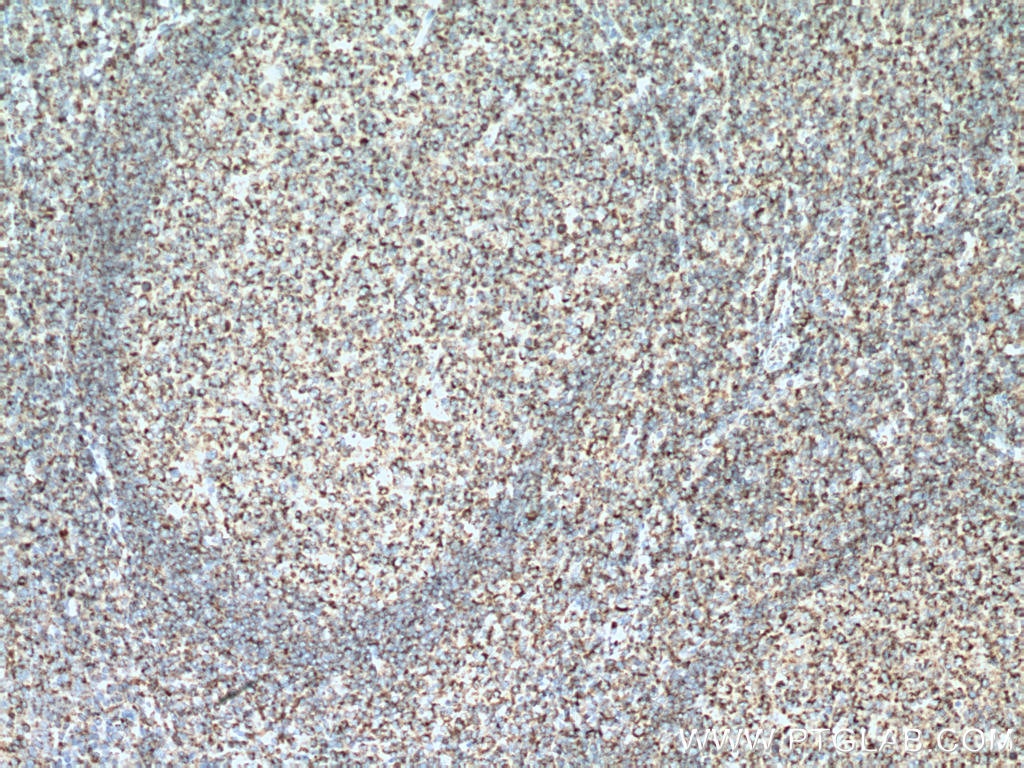 Immunohistochemistry (IHC) staining of human tonsillitis tissue using SLAMF6 Polyclonal antibody (22711-1-AP)