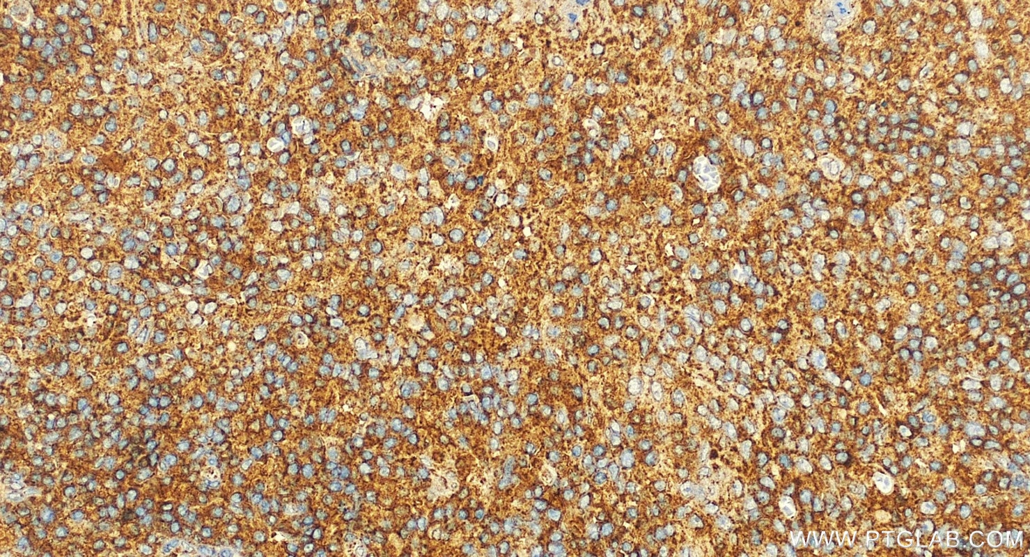 Immunohistochemistry (IHC) staining of human tonsillitis tissue using NTB-A/SLAMF6 Polyclonal antibody (22711-1-AP)
