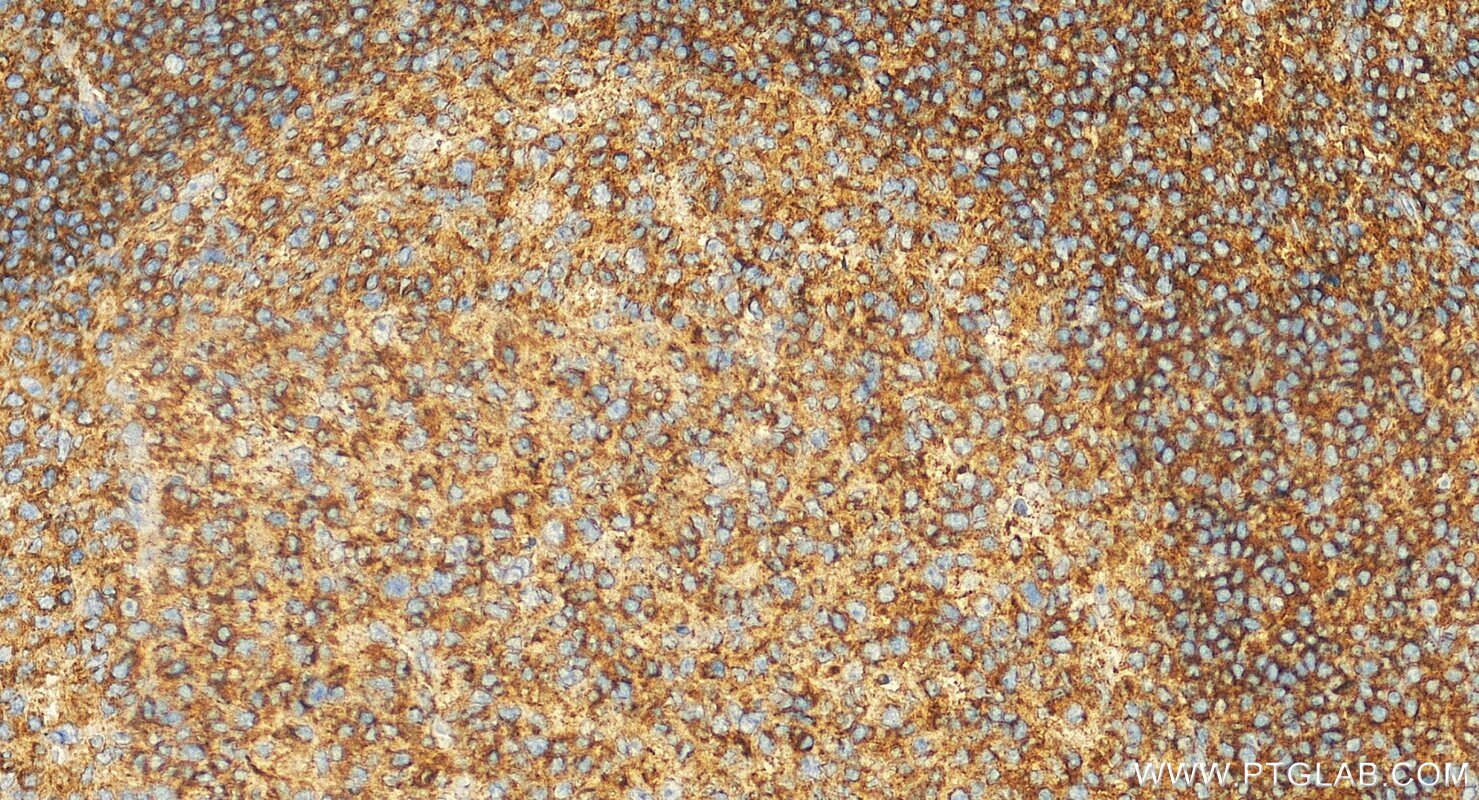 Immunohistochemistry (IHC) staining of human tonsillitis tissue using NTB-A/SLAMF6 Polyclonal antibody (22711-1-AP)