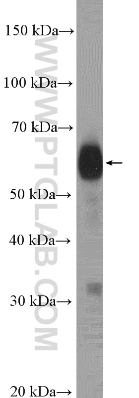Western Blot (WB) analysis of Daudi  cells using SLAMF6 Polyclonal antibody (22711-1-AP)
