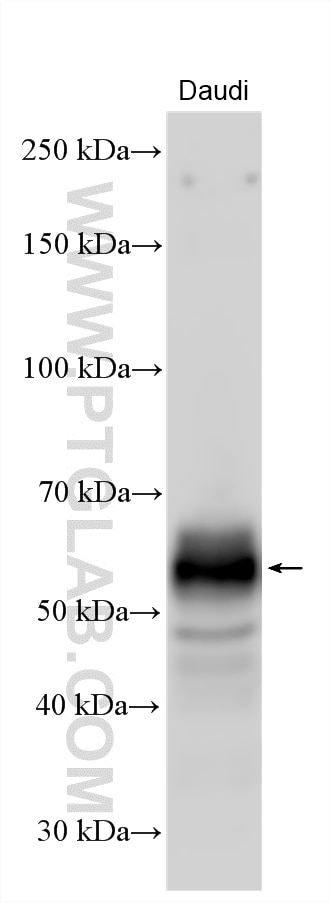 Western Blot (WB) analysis of various lysates using NTB-A/SLAMF6 Polyclonal antibody (22711-1-AP)