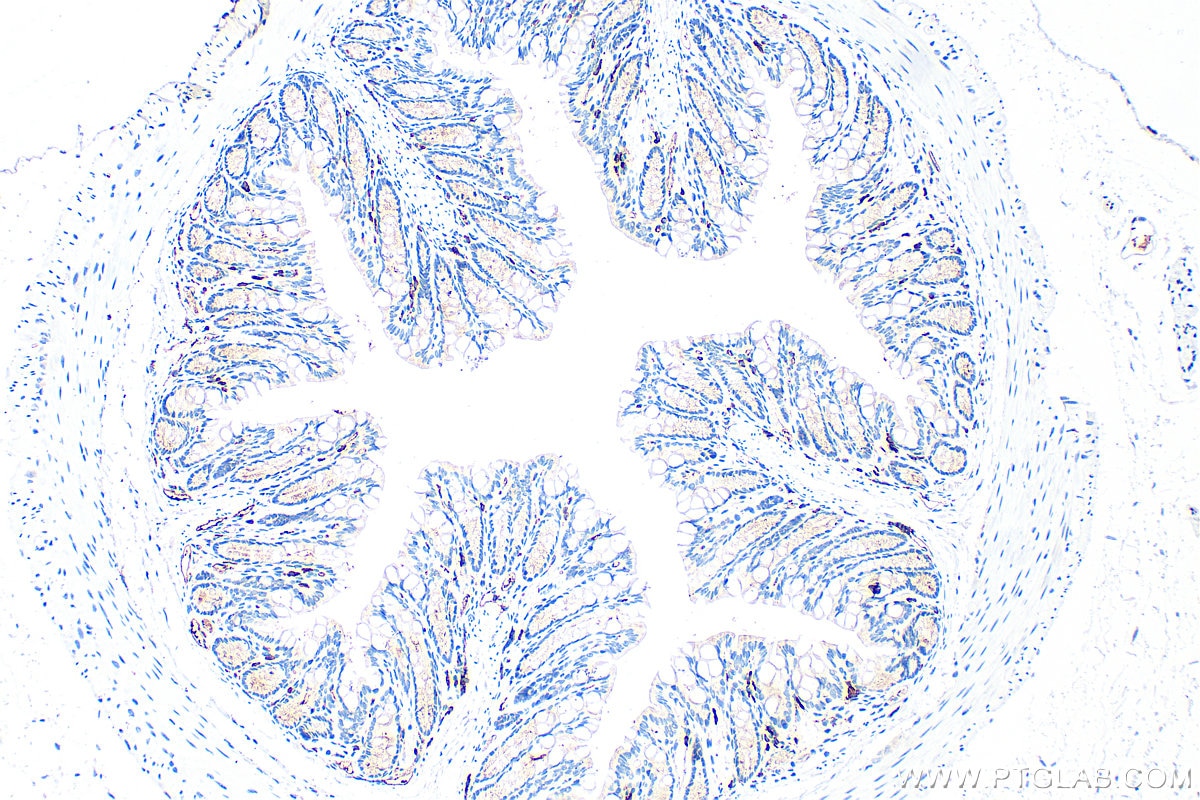 Immunohistochemistry (IHC) staining of mouse colon tissue using SLAMF6 Polyclonal antibody (33396-1-AP)